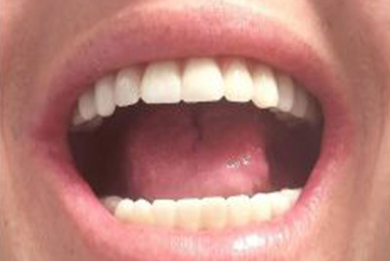 After